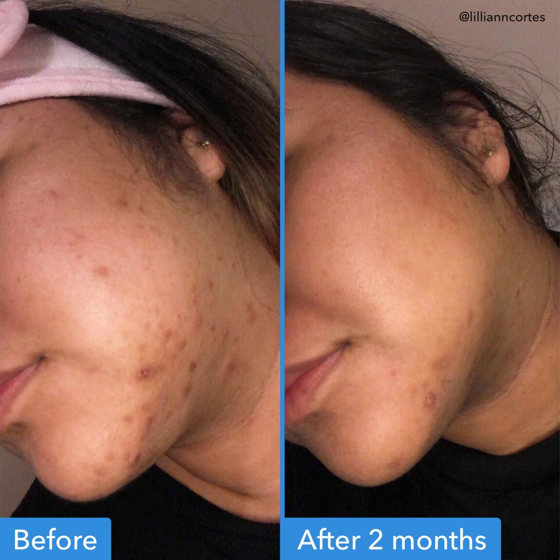 discoloration-correcting-serum-m2 zb_p.jpg