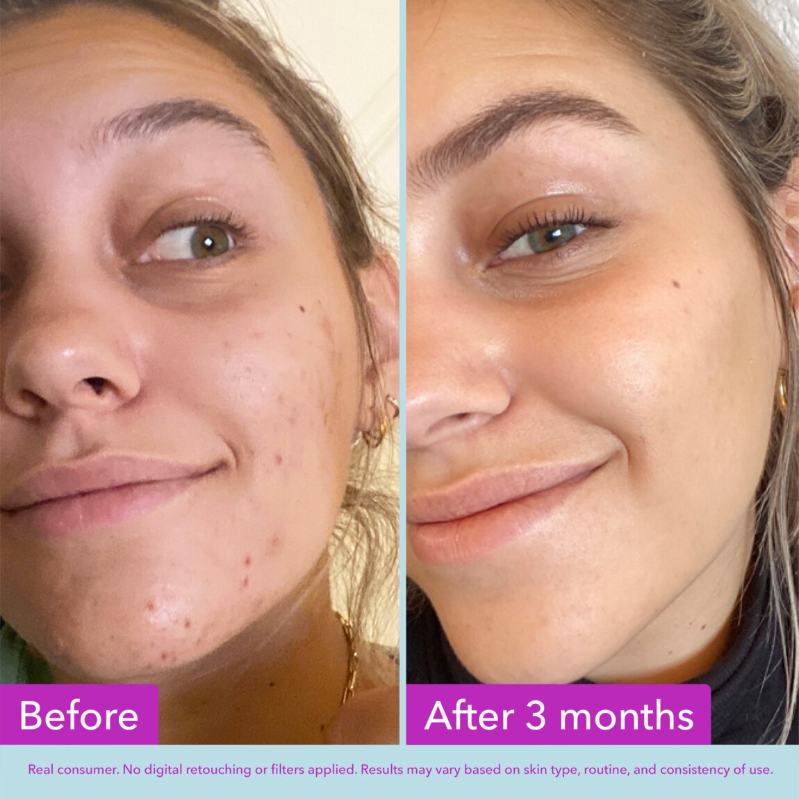 niacinamide-brightening-toner-w5 zb_p.jpg